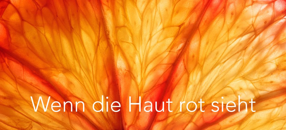 Wenn die Haut rot sieht - WOMEN LOUNGE